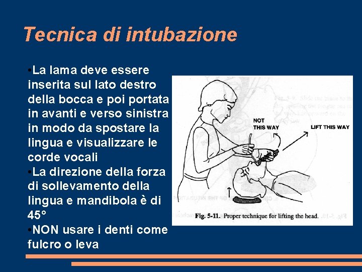 Tecnica di intubazione • La lama deve essere inserita sul lato destro della bocca