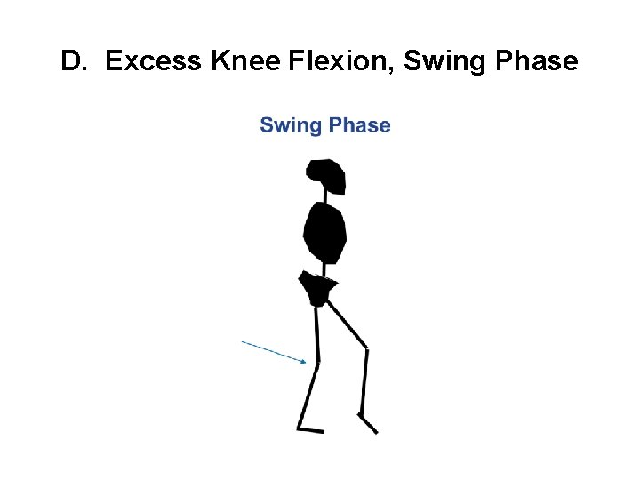 D. Excess Knee Flexion, Swing Phase 