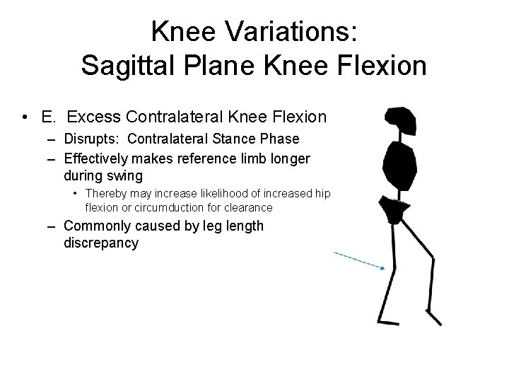 Knee Variations: Sagittal Plane Knee Flexion • E. Excess Contralateral Knee Flexion – Disrupts: