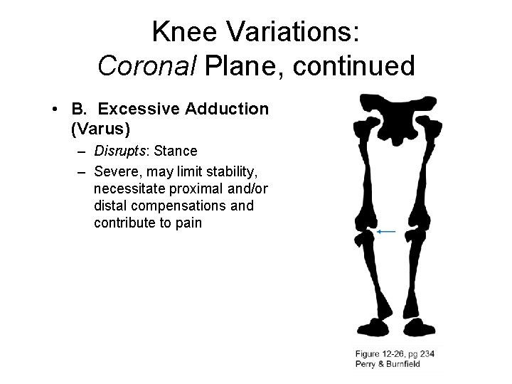 Knee Variations: Coronal Plane, continued • B. Excessive Adduction (Varus) – Disrupts: Stance –