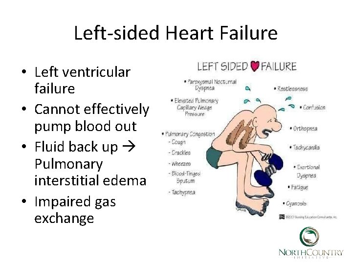 Left-sided Heart Failure • Left ventricular failure • Cannot effectively pump blood out •