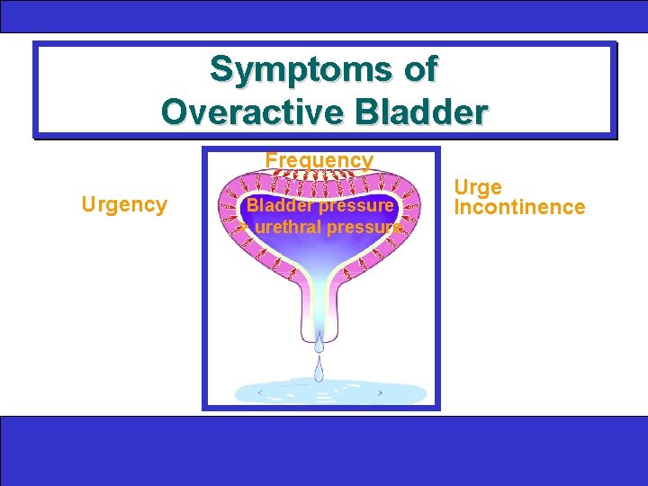 Symptoms of Overactive Bladder Frequency Urgency Bladder pressure > urethral pressure Urge Incontinence 