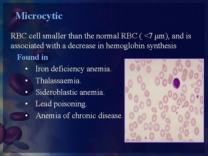 Microcytic RBC cell smaller than the normal RBC ( <7 μm), and is associated