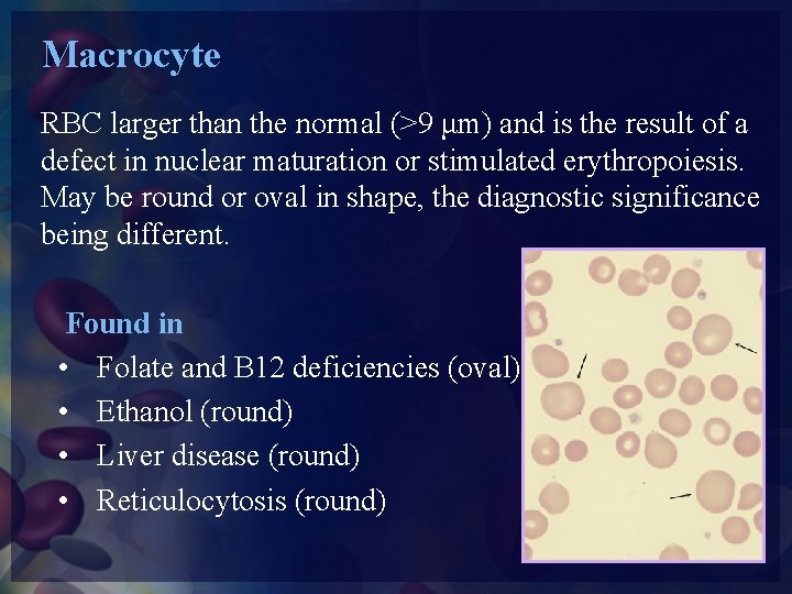 Macrocyte RBC larger than the normal (>9 μm) and is the result of a