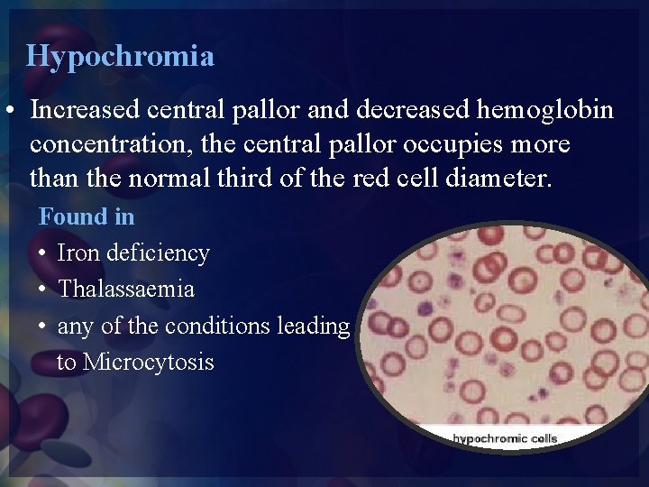 Hypochromia • Increased central pallor and decreased hemoglobin concentration, the central pallor occupies more