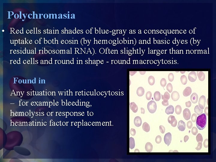 Polychromasia • Red cells stain shades of blue-gray as a consequence of uptake of