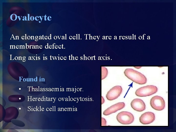 Ovalocyte An elongated oval cell. They are a result of a membrane defect. Long