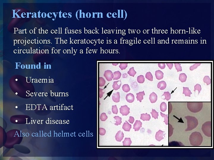 Keratocytes (horn cell) Part of the cell fuses back leaving two or three horn-like