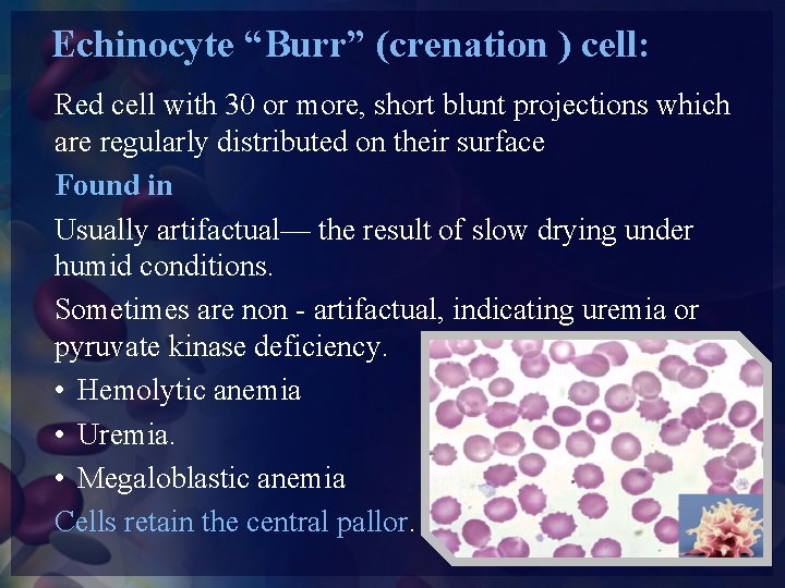 Echinocyte “Burr” (crenation ) cell: Red cell with 30 or more, short blunt projections