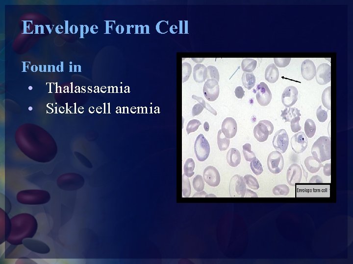 Envelope Form Cell Found in • Thalassaemia • Sickle cell anemia 