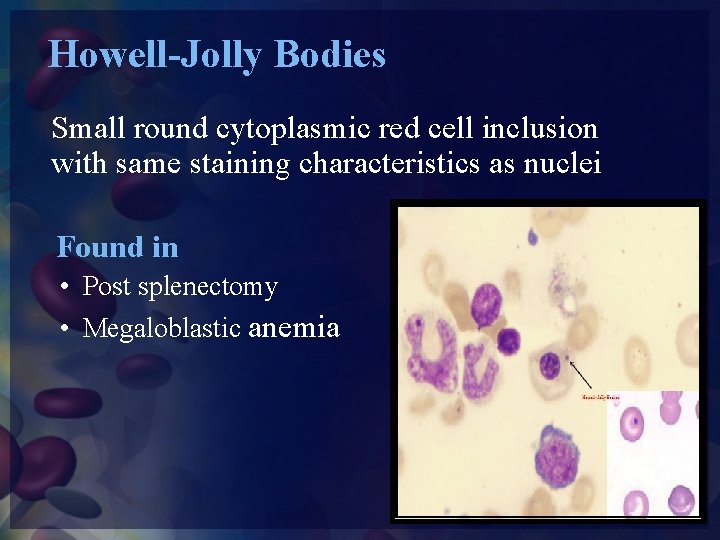 Howell-Jolly Bodies Small round cytoplasmic red cell inclusion with same staining characteristics as nuclei