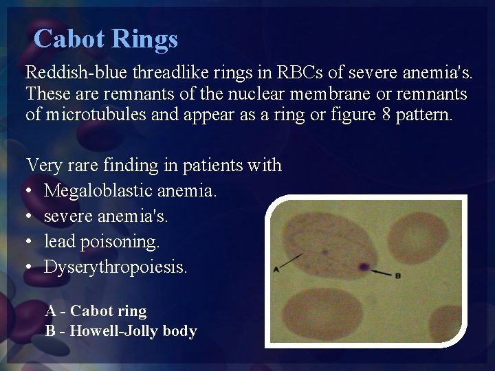 Cabot Rings Reddish-blue threadlike rings in RBCs of severe anemia's. These are remnants of