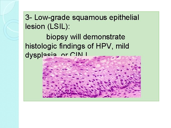 3 - Low-grade squamous epithelial lesion (LSIL): biopsy will demonstrate histologic findings of HPV,