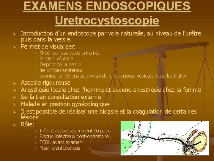 EXAMENS ENDOSCOPIQUES Uretrocystoscopie Introduction d’un endoscope par voie naturelle, au niveau de l’urètre puis