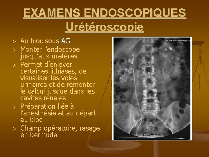 EXAMENS ENDOSCOPIQUES Urétéroscopie Au bloc sous AG Monter l’endoscope jusqu’aux uretères Permet d’enlever certaines