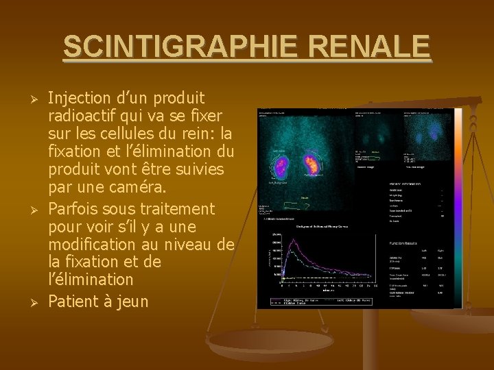 SCINTIGRAPHIE RENALE Injection d’un produit radioactif qui va se fixer sur les cellules du