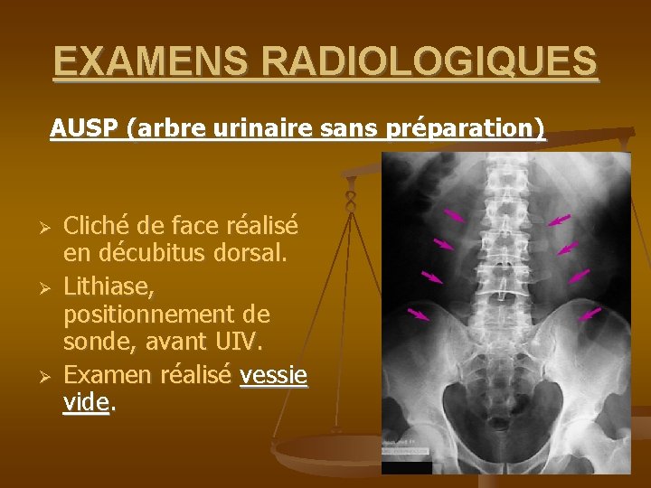 EXAMENS RADIOLOGIQUES AUSP (arbre urinaire sans préparation) Cliché de face réalisé en décubitus dorsal.
