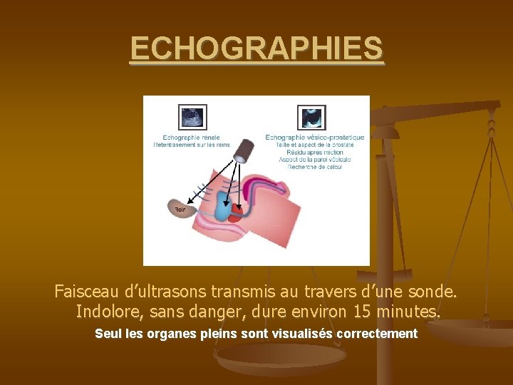 ECHOGRAPHIES Faisceau d’ultrasons transmis au travers d’une sonde. Indolore, sans danger, dure environ 15