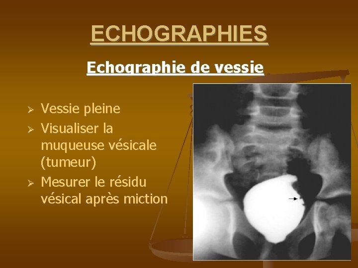 UROLOGIENEPHROLOGIE EXAMENS COMPLEMENTAIRES EXAMENS RADIOLOGIQUES AUSP
