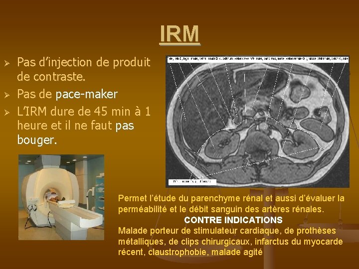 UROLOGIENEPHROLOGIE EXAMENS COMPLEMENTAIRES EXAMENS RADIOLOGIQUES AUSP arbre urinaire