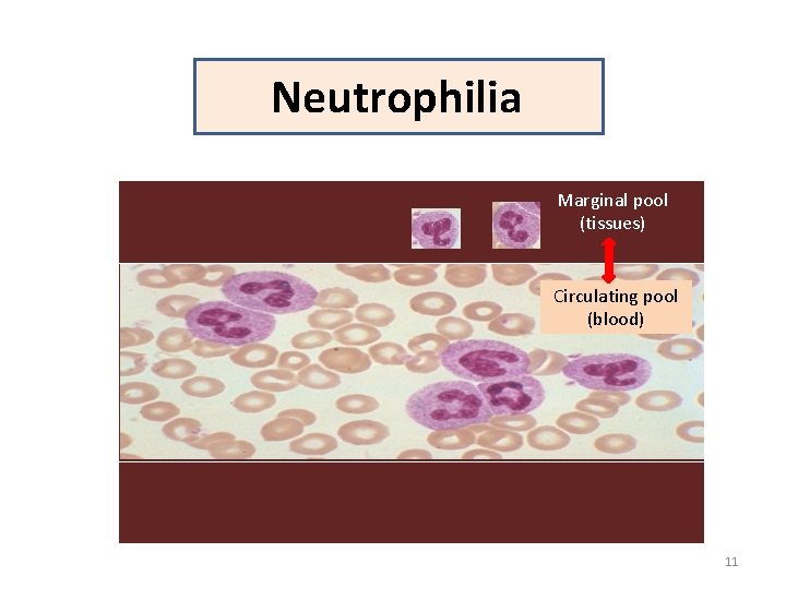 Neutrophilia Marginal pool (tissues) Circulating pool (blood) 11 