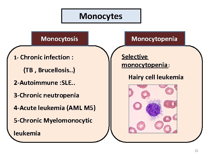 Monocytes Monocytosis 1 - Chronic infection : (TB , Brucellosis. . ) 2 -Autoimmune