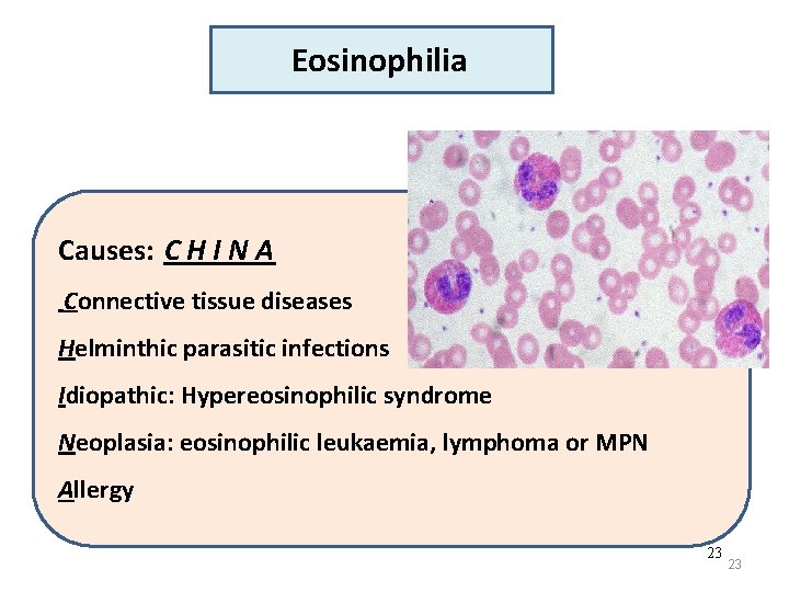 Eosinophilia Causes: C H I N A Connective tissue diseases Helminthic parasitic infections Idiopathic: