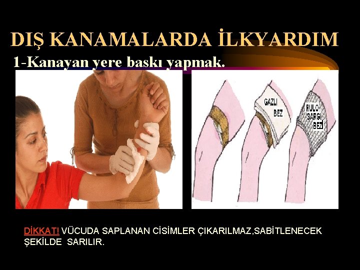 DIŞ KANAMALARDA İLKYARDIM 1 -Kanayan yere baskı yapmak. DİKKAT! VÜCUDA SAPLANAN CİSİMLER ÇIKARILMAZ, SABİTLENECEK