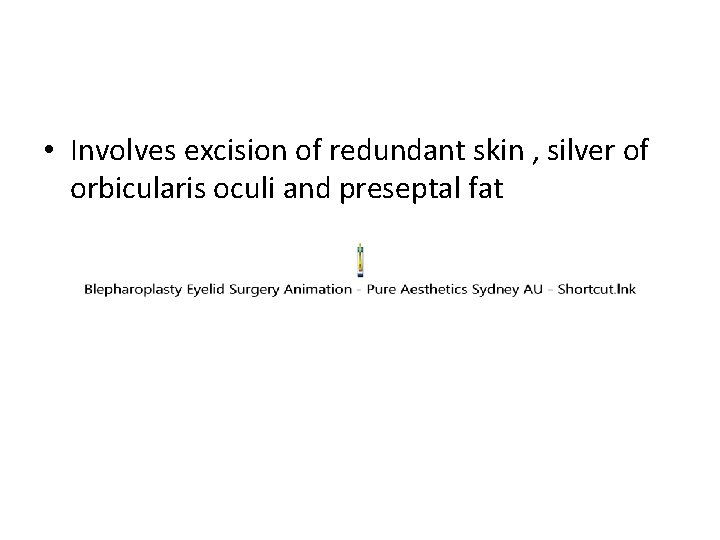  • Involves excision of redundant skin , silver of orbicularis oculi and preseptal