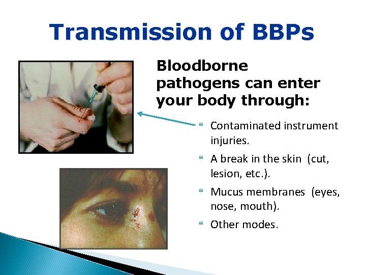 Transmission of BBPs Bloodborne pathogens can enter your body through: Contaminated instrument injuries. A