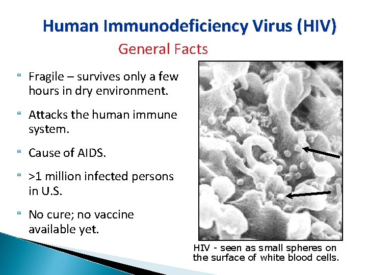 Human Immunodeficiency Virus (HIV) General Facts Fragile – survives only a few hours in