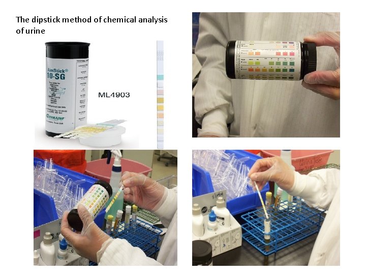 The dipstick method of chemical analysis of urine 