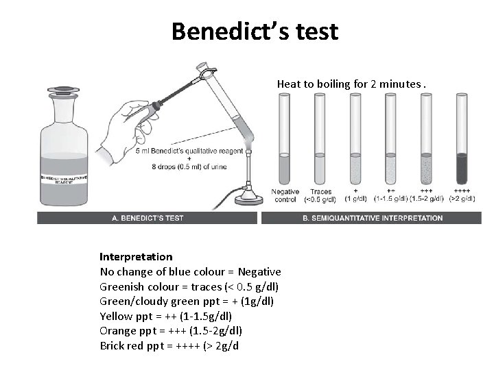 Benedict’s test Heat to boiling for 2 minutes. Interpretation No change of blue colour