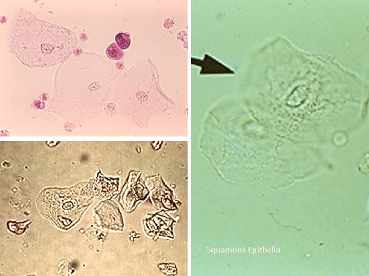 Squamous Epithelia 