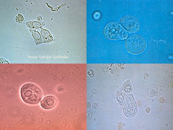 Renal Tubular Epithelia 