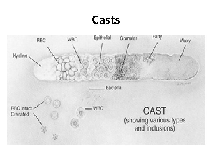 Casts 