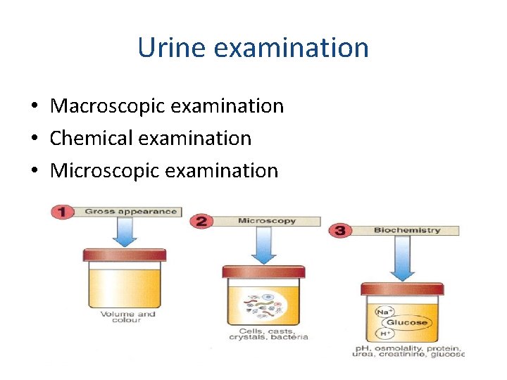 Urine examination • Macroscopic examination • Chemical examination • Microscopic examination 