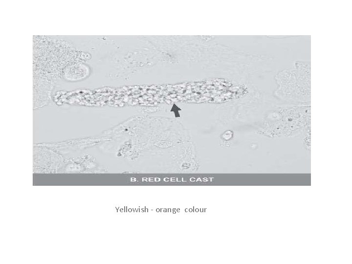 Yellowish - orange colour 
