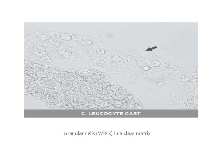 Granular cells (WBCs) in a clear matrix 