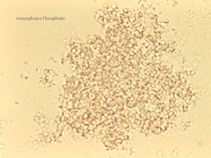 Amorphous Phosphate 