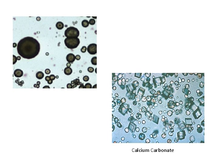 Calcium Carbonate 