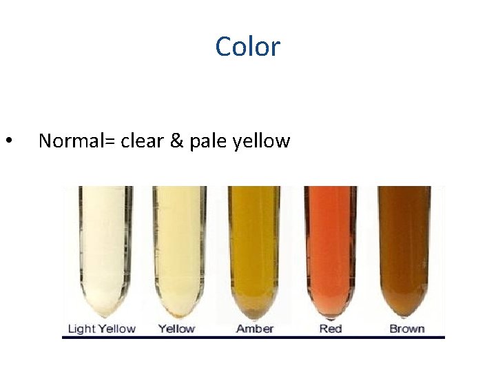 Color • Normal= clear & pale yellow 