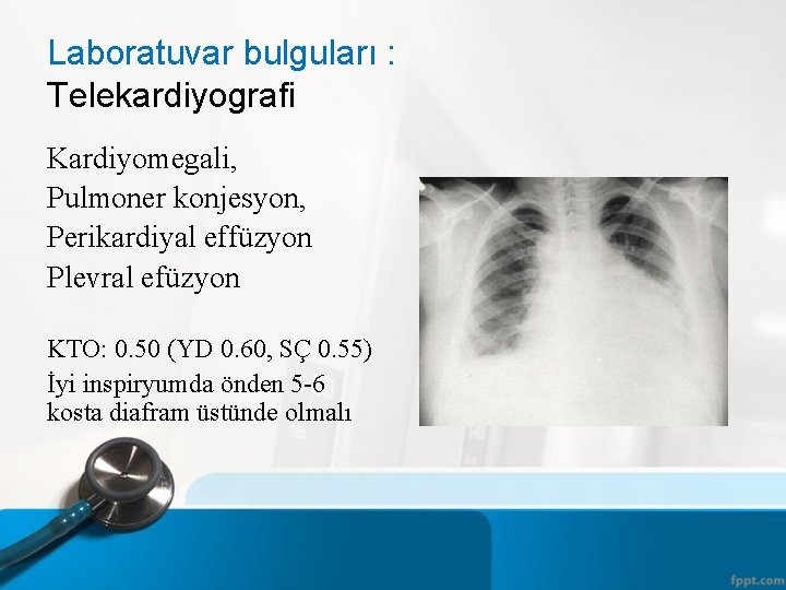 Laboratuvar bulguları : Telekardiyografi Kardiyomegali, Pulmoner konjesyon, Perikardiyal effüzyon Plevral efüzyon KTO: 0. 50