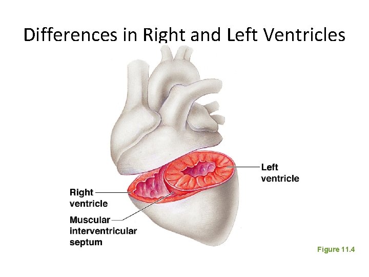 Differences in Right and Left Ventricles Figure 11. 4 