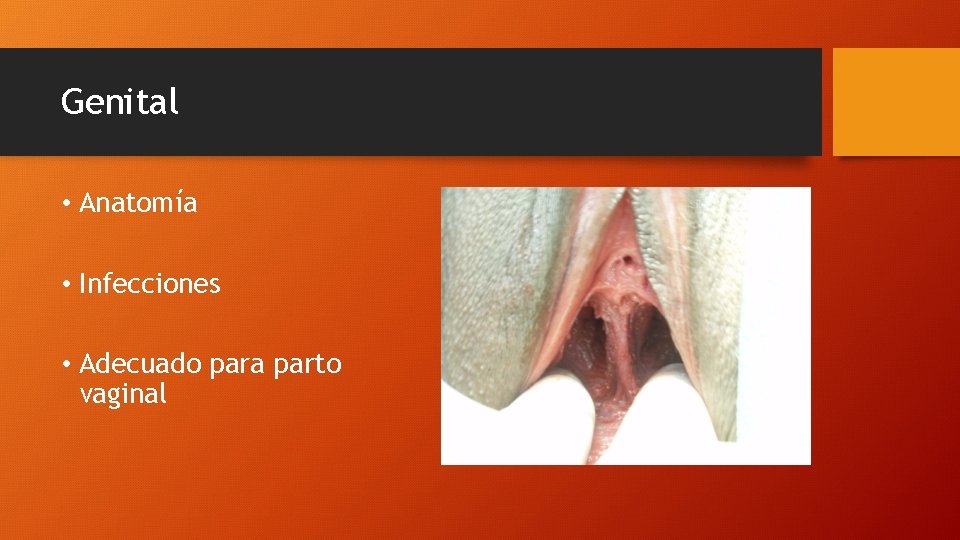 Genital • Anatomía • Infecciones • Adecuado para parto vaginal 