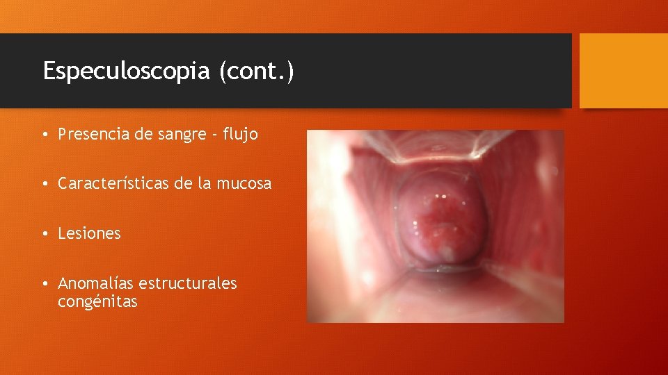 Especuloscopia (cont. ) • Presencia de sangre - flujo • Características de la mucosa