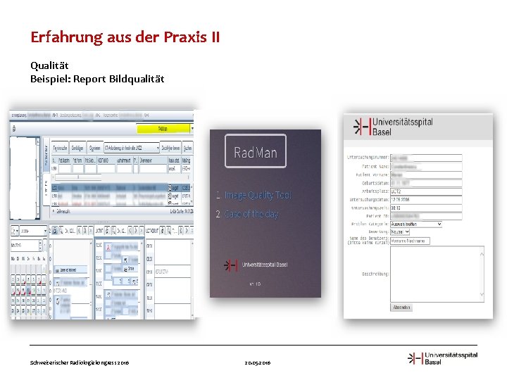 Erfahrung aus der Praxis II Qualität Beispiel: Report Bildqualität Schweizerischer Radiologiekongress 2016 20. 05.
