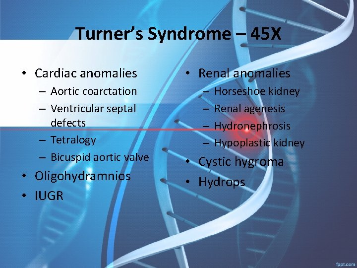 Turner’s Syndrome – 45 X • Cardiac anomalies – Aortic coarctation – Ventricular septal