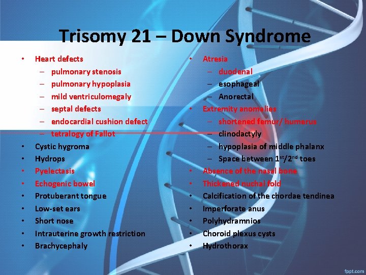 Trisomy 21 – Down Syndrome • • • Heart defects – pulmonary stenosis –