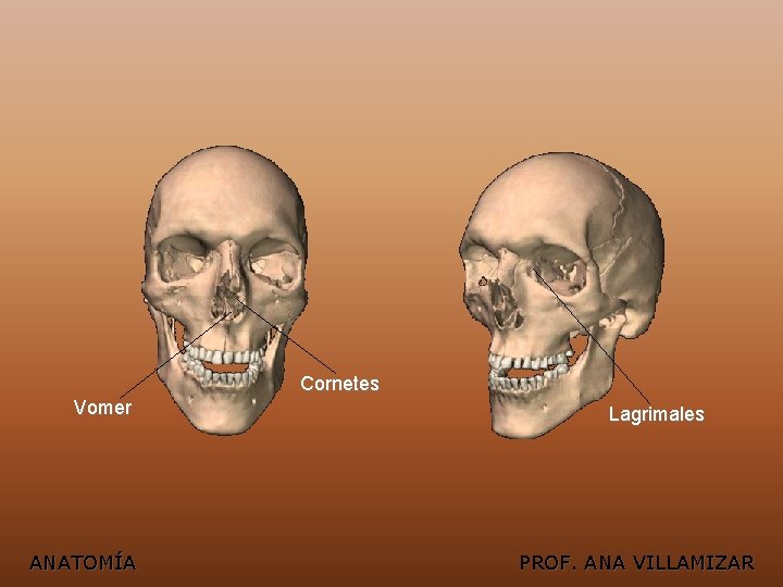 Cornetes Vomer ANATOMÍA Lagrimales PROF. ANA VILLAMIZAR 